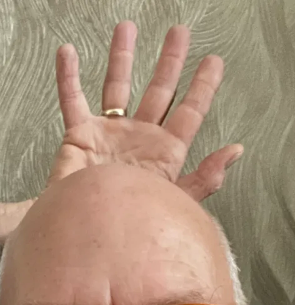 Wanneer je emotionele antennes voortdurend naar buiten gericht staan, op zoek naar mogelijke dreiging, mislukking, pijn of verdriet bij de ander. 
